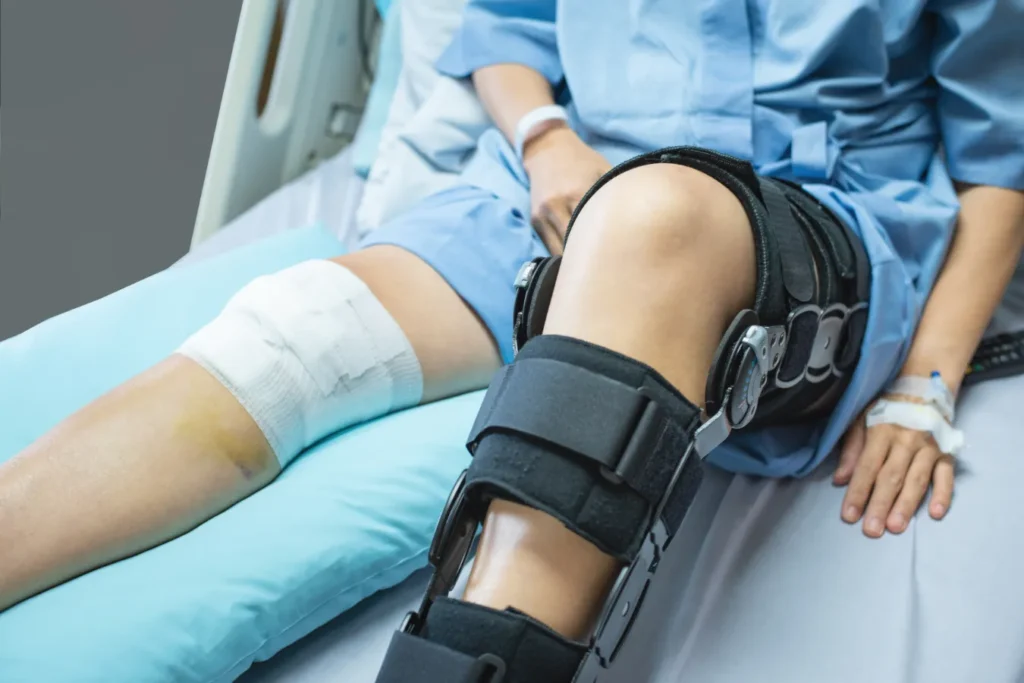 A close up of a patient with a knee brace on one leg and a wrap on the other knee